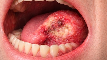 Con una foto bucal se