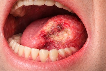 (Imagen Ilustrativa Infobae)