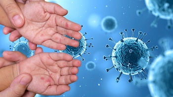 ¿Qué es el sarampión y qué síntomas tiene? Conoce todo sobre la enfermedad que mantiene en alerta al Perú