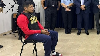 Especialista explica que Erick Moreno