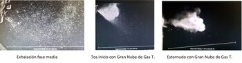 Aerobiología, por el doctor Lombardero