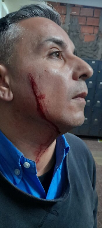 Los delicuentes le cortaron la