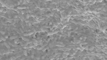 Bacterias. (Infobae Argentina)