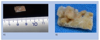 Investigadores confirmaron que pertenece a