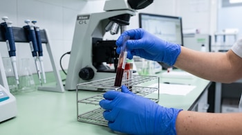 Manos con guantes azules sostienen un tubo de ensayo con sangre sobre una gradilla metálica, frente a un microscopio y pipetas de laboratorio.
