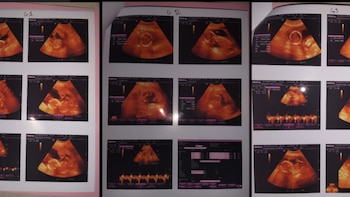 Mamá de trillizas dio a luz en Sinaloa y acusa que no le entregaron a una: esto dijo el hospital
