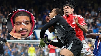 Las escalofriantes fotos de las lesiones que sufrió un futbolista en la Premier League tras chocar con el arquero