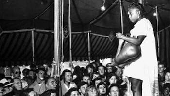 Vivió con un gemelo “parásito”