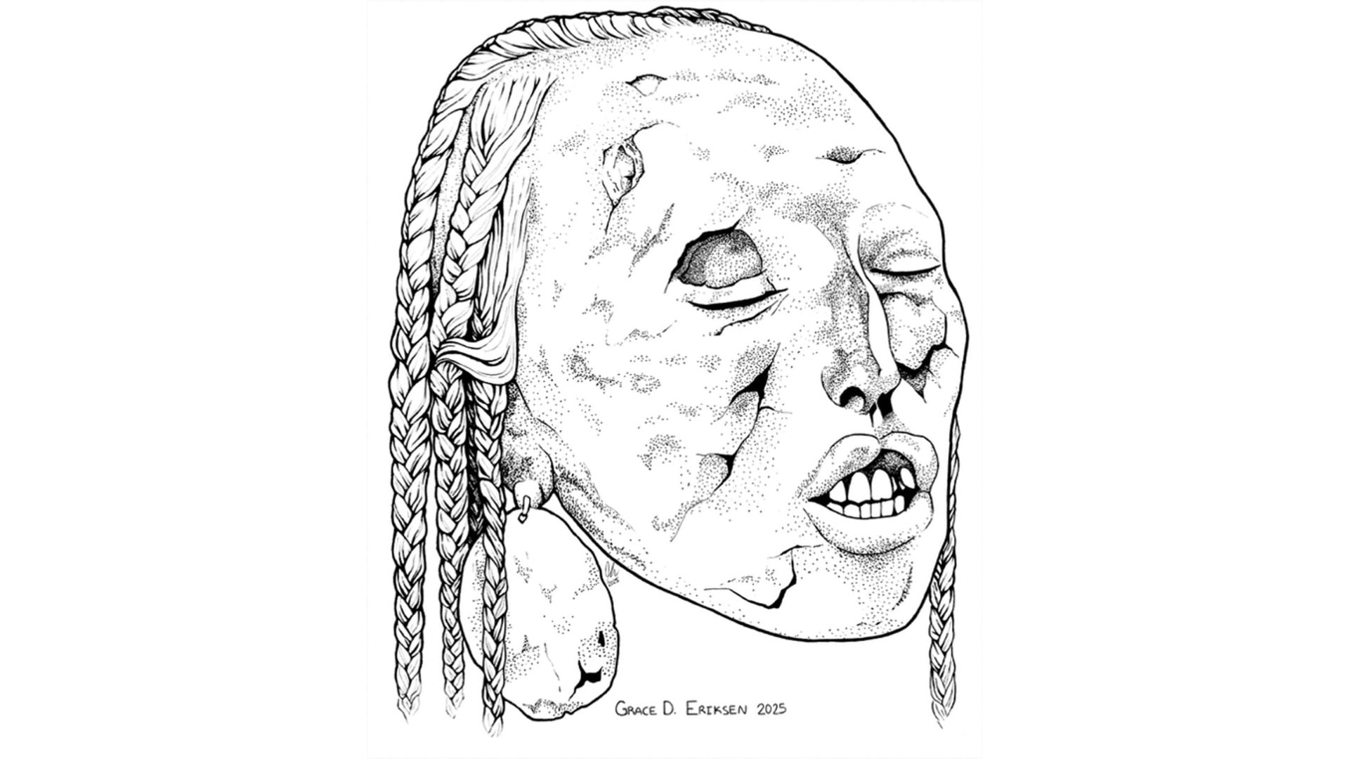 La cabeza trofeo andina con labio hendido hallada en Paracas representa el primer caso documentado de esta malformación en restos rituales - Crédito: Grace D. Eriksen en Scaffidi 2025