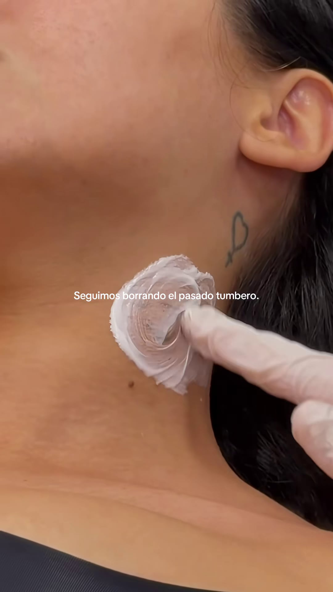 La Reini mostró el paso a paso de su tratamiento en la piel para eliminar los tatuajes