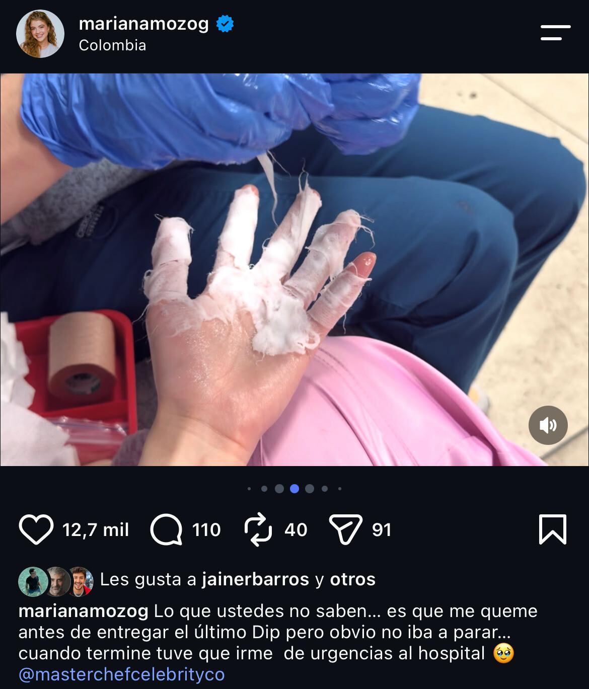 La participante sufrió una quemadura por la que debió ausentarse de la competencia - crédito @marianamozog/IG