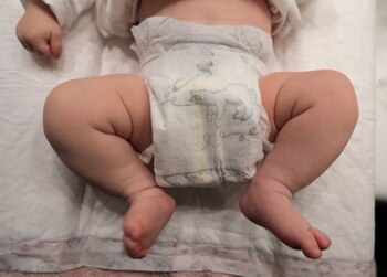 Imagen de un bebé con