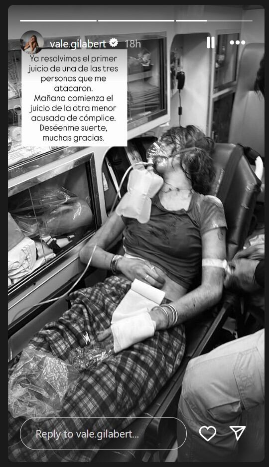 Marianne Gonzaga fue detenida en la CDMX por apuñalar a Valentina Gilabert, novia de su expareja. (IG)