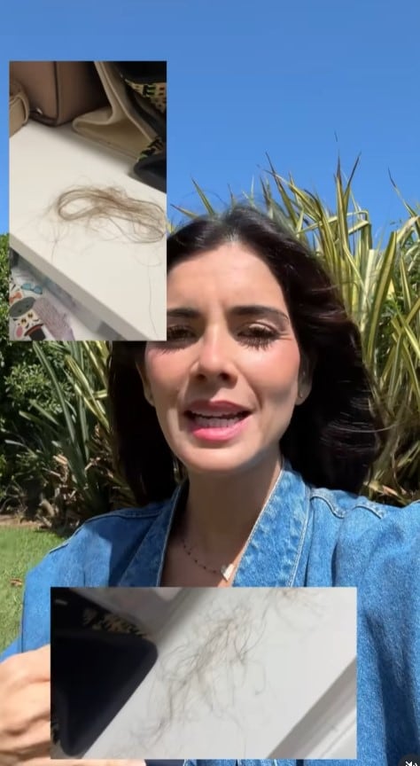 Korina Rivadeneira revela que la caída masiva de su cabello fue la señal que la llevó a descubrir su enfermedad. Infobae Perú / Captura: IG