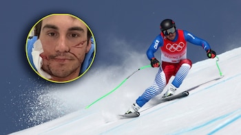 Un esquiador chileno sufrió un