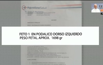 “Quiero que me entreguen a mis dos bebés”: madre denuncia que solo recibió una de sus gemelas en hospital del Callao. Captura: Cuarto Poder.