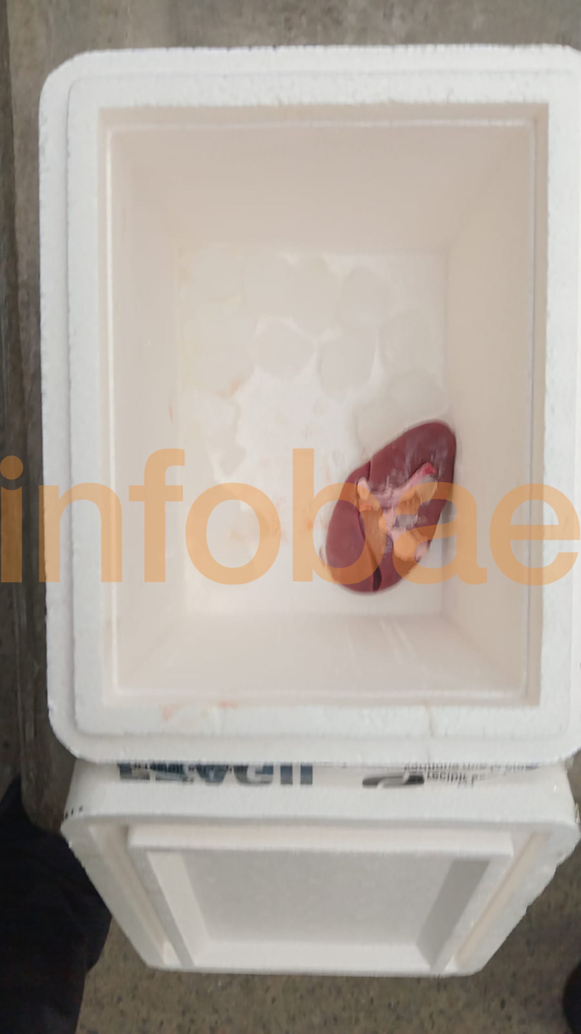Un perito de la Morgue Judicial de la Corte Suprema confirmó que se trataba de un riñón no humano