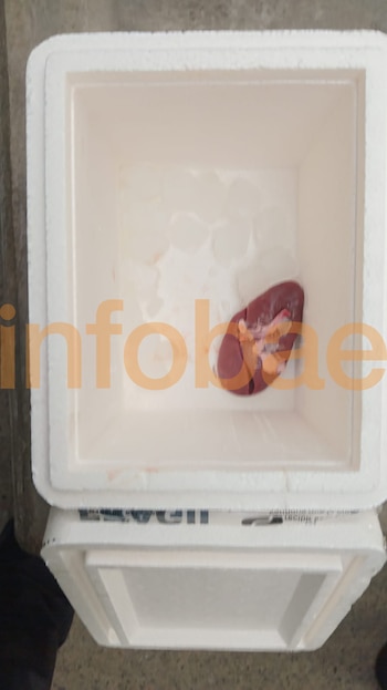 Un recipiente de poliestireno blanco abierto que contiene un órgano humano sobre una base refrigerada