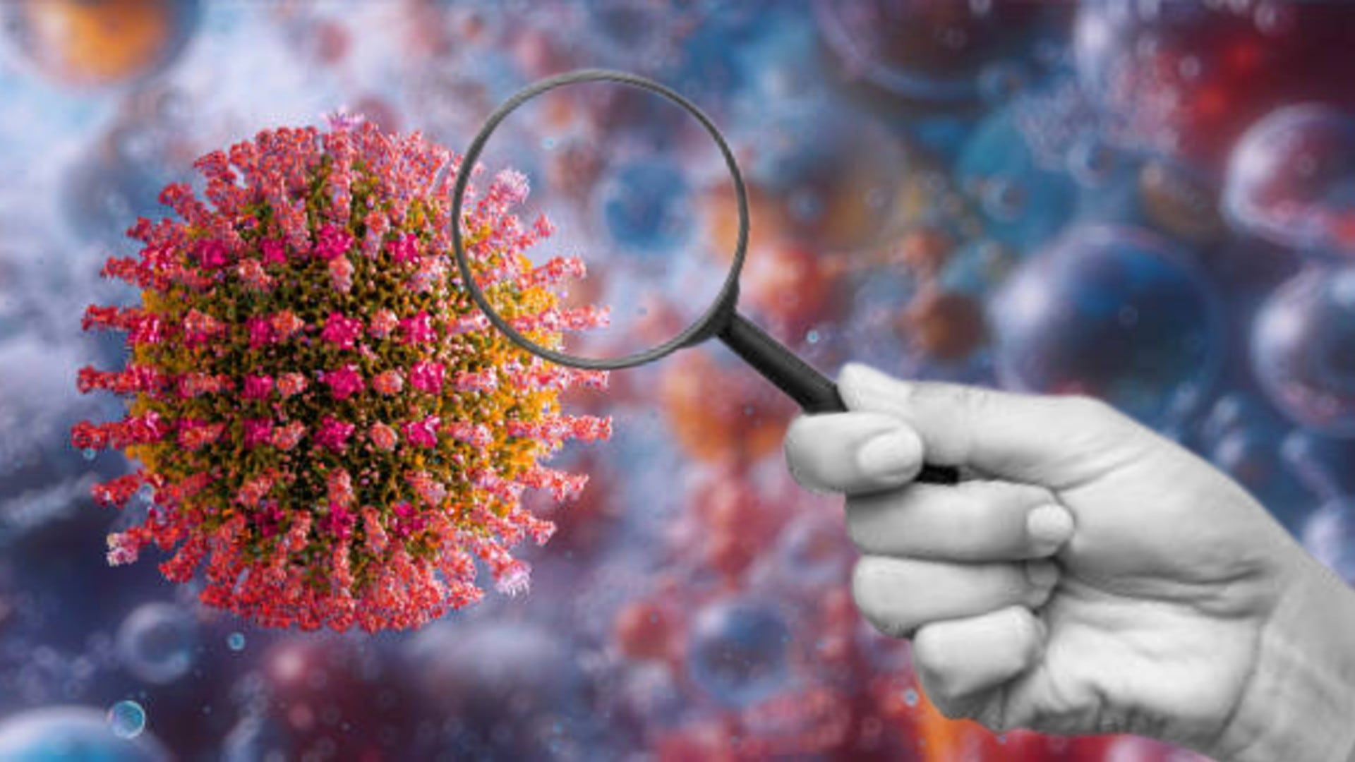 El brote de sarampión podría extenderse durante meses o años si no se alcanza la inmunización colectiva en México. Diseño: (Jesús Tovar Sosa/Infobae)