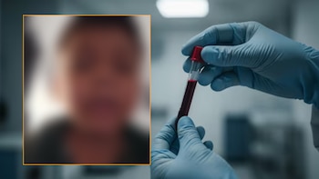 Niño con hemofilia lleva 15 días sin su medicamento, está en la UCI y tiene moretones y sangrados: “Puedo quedar con esa pierna dañada”