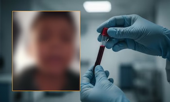 Samuel España padece de hemofilia A severa. La EPS Asmet Salud debe garantizar su tratamiento - crédito captura de pantalla video @Fecoer/X y VisualesIA/Imagen Ilustrativa Infobae