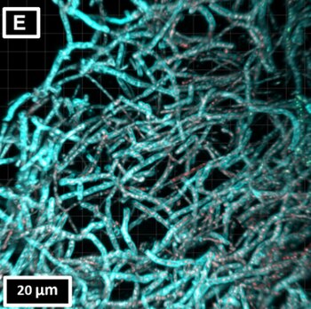 Un biomaterial pionero que utiliza