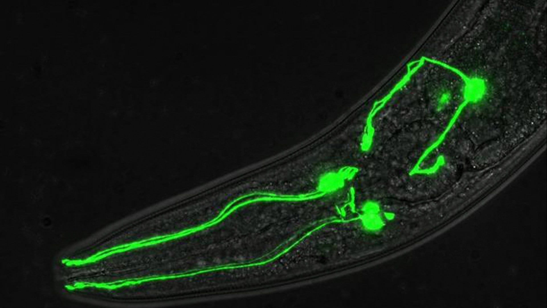Los gusanos C. elegans son nematodos microscópicos utilizados como modelo en investigaciones biológicas por su simpleza y similitud genética con los humanos/Archivo