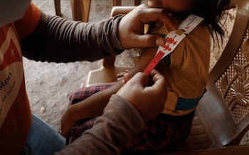 La desnutrición infantil en Guatemala afecta a casi la mitad de los niños menores de cinco años y el sistema oficial registró 11.241 casos de desnutrición aguda y 16 muertes en lo que va del año.