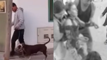Una mujer resultó gravemente herida tras ser mordida por un perro pitbull que saltó desde el techo de una vivienda en Comas.