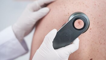 Día Mundial del Cáncer de