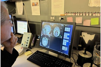 Investigadores descubren que la imaginación activa áreas avanzadas del cerebro