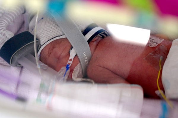 El nacimiento de cuatrillizas idénticas en Brisbane sorprendió al personal médico y a la familia Na’amoana (METRO NORTH HEALTH)
