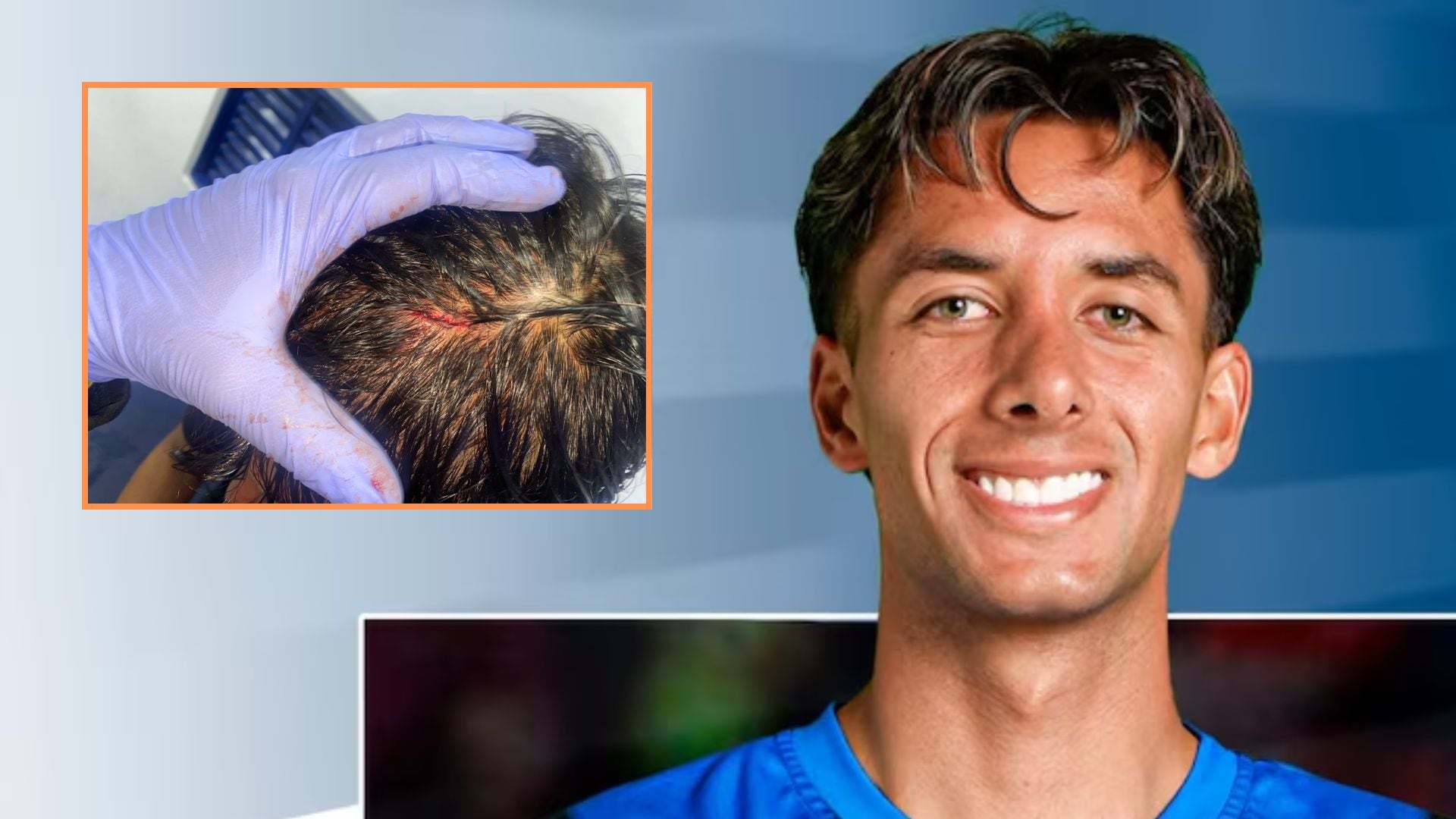 Jacobo Pimentel quedó con contusiones en la cabeza y un corte en el labio - crédito Boyacá Chicó Fútbol Club