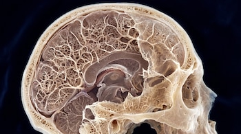 Vista de perfil de un corte transversal hiperrealista del cráneo humano, mostrando una intrincada red de microcanales óseos contra un fondo oscuro.
