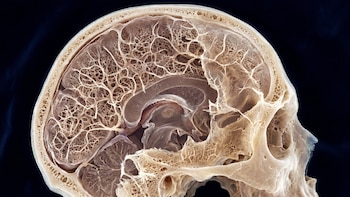 Científicos descubrieron un nuevo sistema de defensa en el cráneo que protege al cerebro
