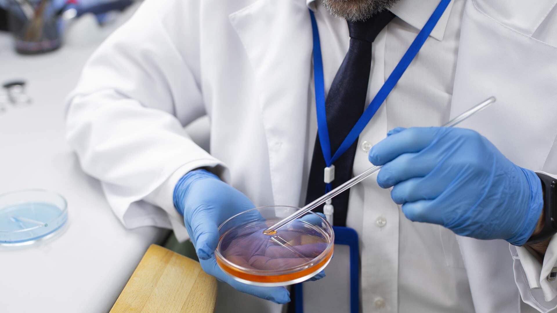 Se exploró cómo la bacteria modifica su preferencia por fuentes de carbono en condiciones de bajo magnesio y altos niveles de la molécula cAMP (Freepik)