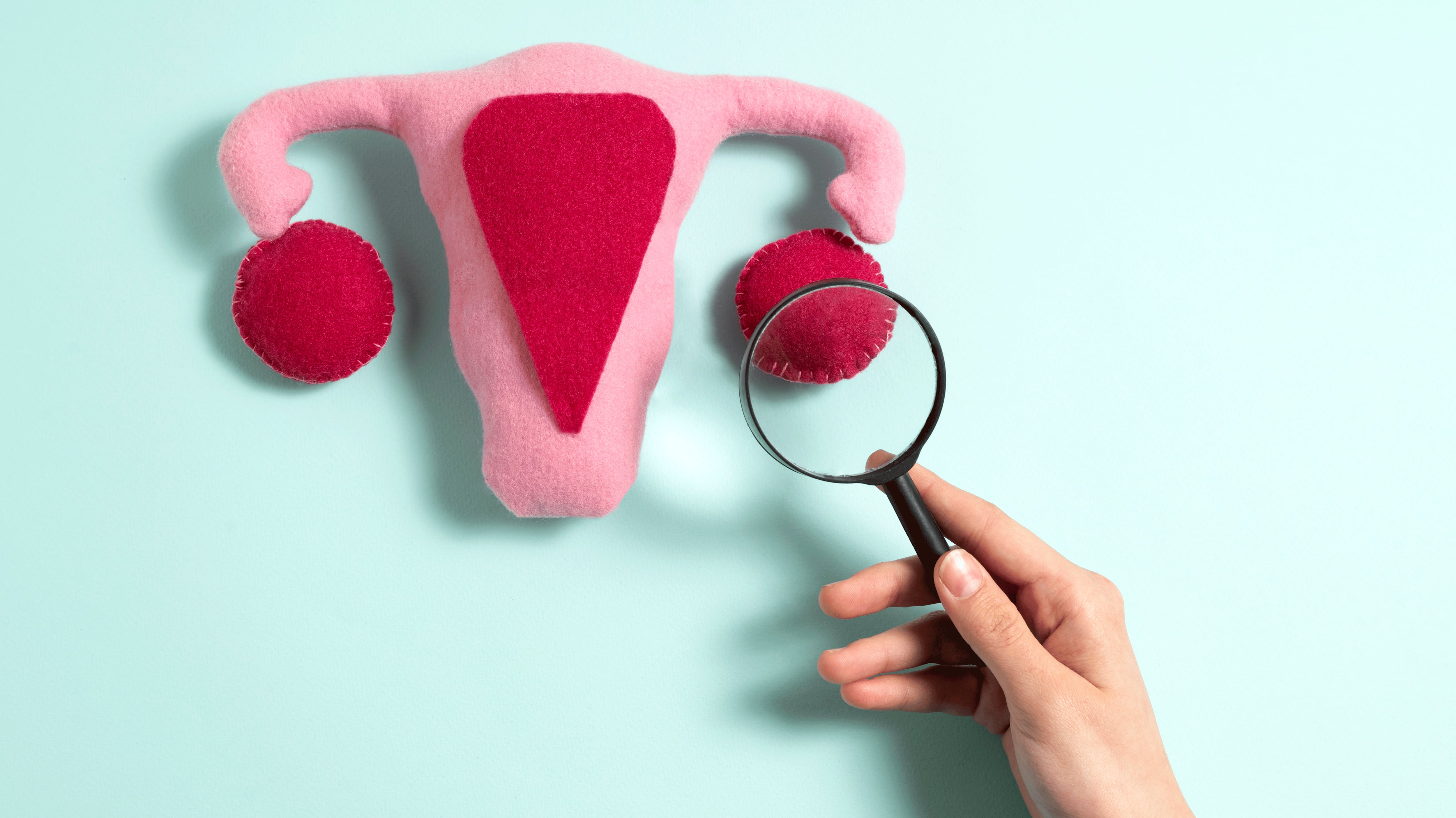 La endometriosis se caracteriza por el crecimiento de tejido similar al endometrio fuera del útero, con localizaciones frecuentes en ovarios, trompas de Falopio, intestino, vejiga y diafragma (Freepik)