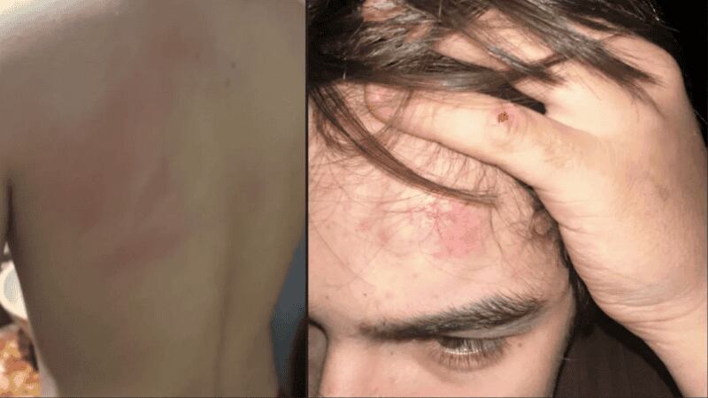 El padre del adolescente fue a pedir explicaciones y recibió insultos y amenazas por parte del denunciado