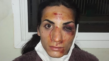 Katherine tras la golpiza que