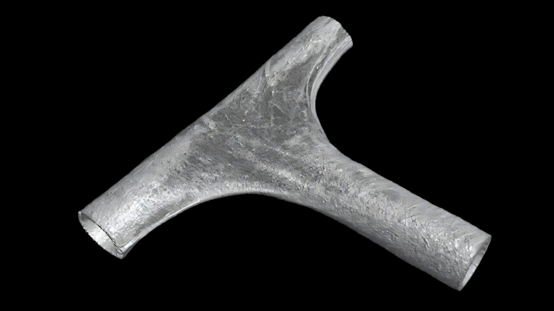 Innovador injerto vascular que podría fabricarse en quirófano en minutos