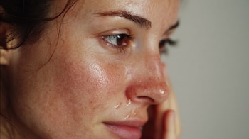 El uso de SNOIL Skin Natural Rejuvenation Oil podría provocar irritación, enrojecimiento o empeorar condiciones de la piel, según la alerta del Invima sobre este producto ilegal - crédito Imagen Ilustrativa Infobae