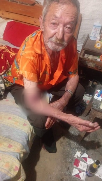 El adulto mayor quedó con una lesión en uno de sus brazos - crédito Periódico El Tunjano / Facebook