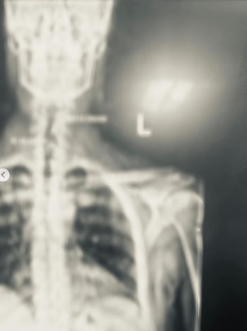 Gian Marco revela detalles de