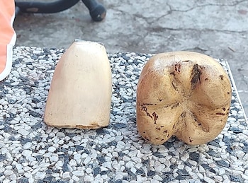 Los dientes del muñeco de