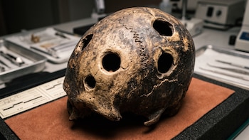 Neurocirugía prehistórica: cómo los instrumentos de piedra garantizaban la vida de los pacientes en la antigüedad