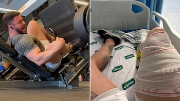 La escalofriante lesión que sufrió