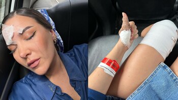 ‘El Gran Chef Famosos’: Ale Fuller sufrió fuertes quemaduras mientras abría una lata caliente de leche condensada. Latina TV. Instagram