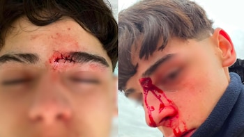 Agredieron a los jugadores del Club Bella Vista tras un partido de fútbol y acusaron a una madre del equipo rival