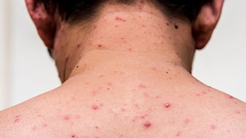 Recientemente, cuatro ciudadanos uruguayos recorrieron