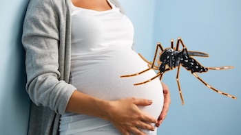 Si bien no todas las